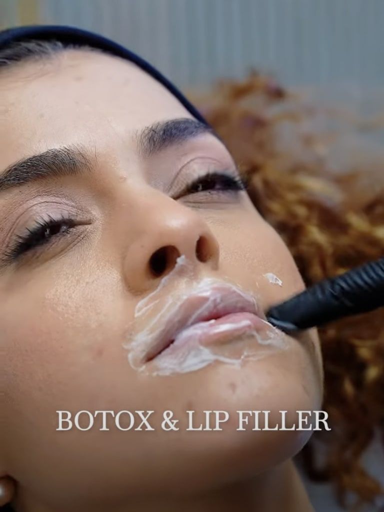 Natural Botox Results You’ll Love | Dubai Client Transformations