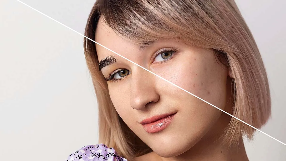 Skin Treatment in Dubai