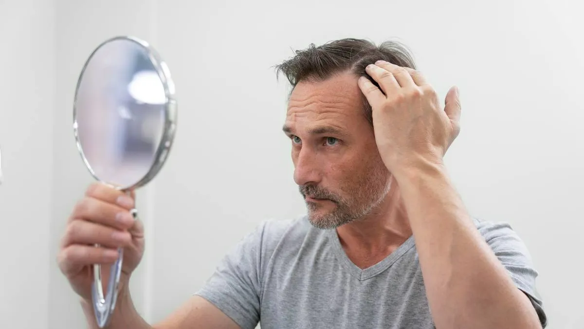 Hair Transplant Cost in Dubai Blog