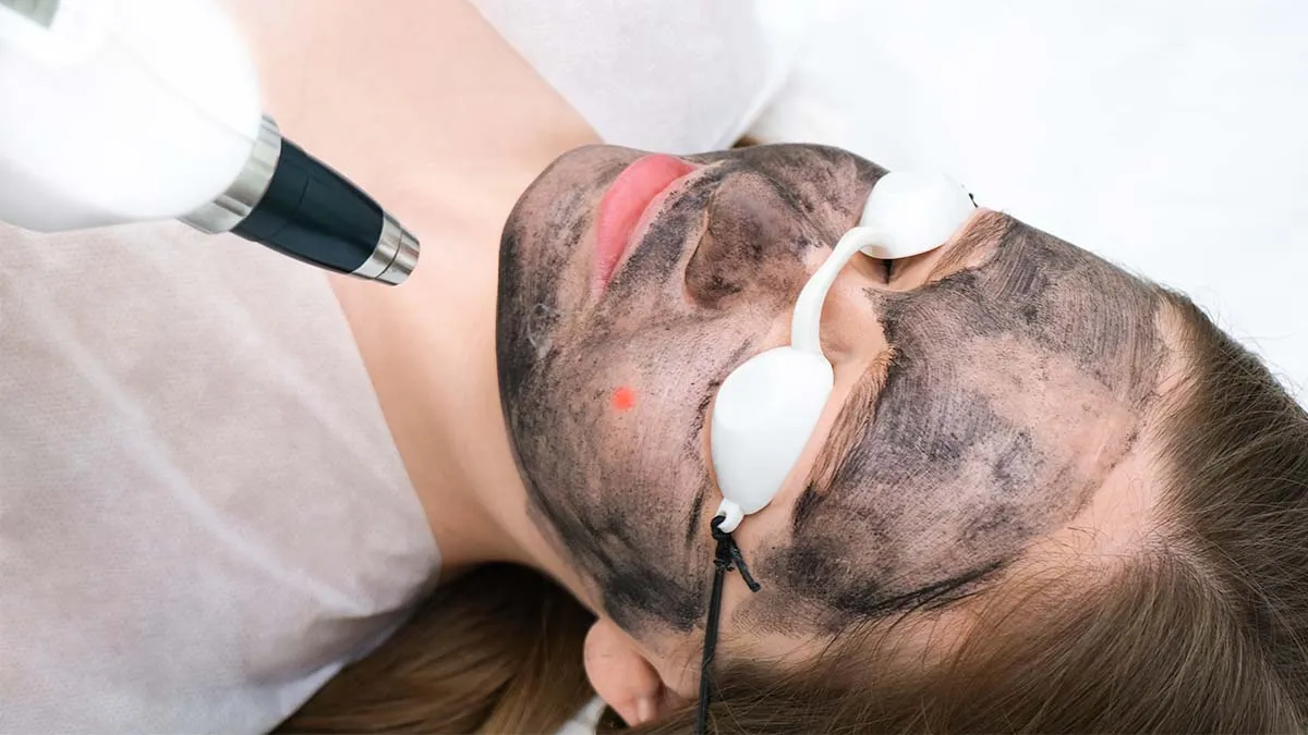 Carbon Laser Face Rejuvenation in Dubai